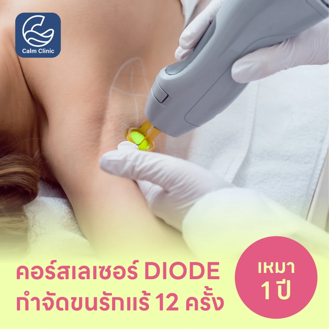 คอร์สเลเซอร์กำจัดขนรักแร้ 12 ครั้ง ด้วย Diode Laser