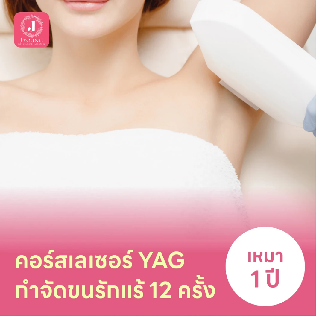 คอร์สเลเซอร์กำจัดขนรักแร้ 12 ครั้ง ด้วย YAG Laser
