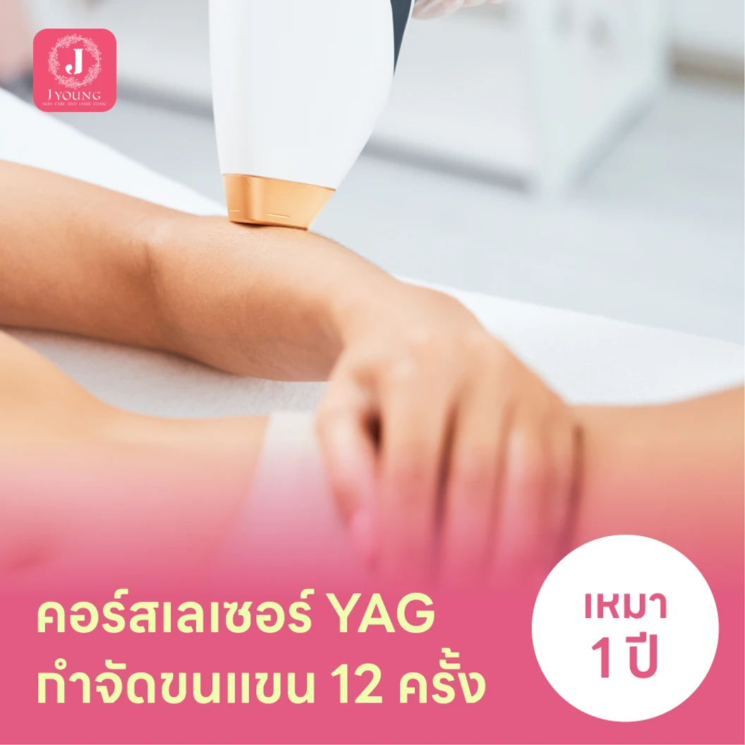 คอร์สเลเซอร์กำจัดขนแขน 12 ครั้ง ด้วย YAG Laser