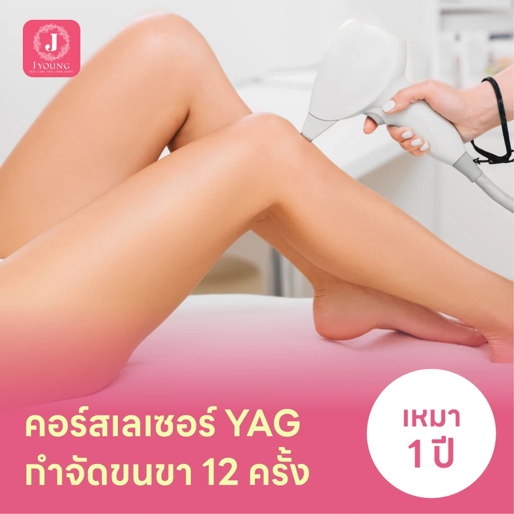 คอร์สเลเซอร์กำจัดขนขา 12 ครั้ง ด้วย YAG Laser