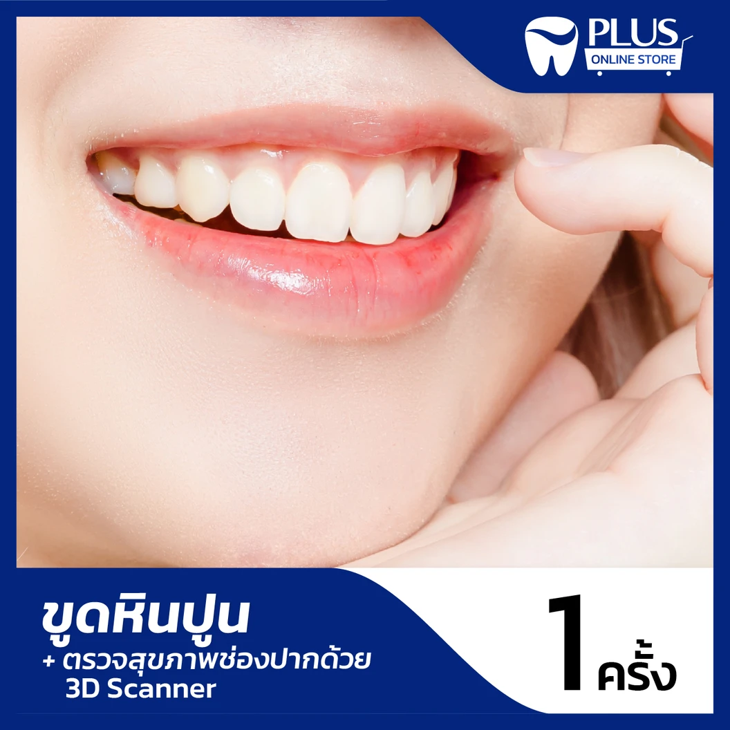 ขูดหินปูน + ตรวจสุขภาพช่องปาก ด้วย 3D Scanner