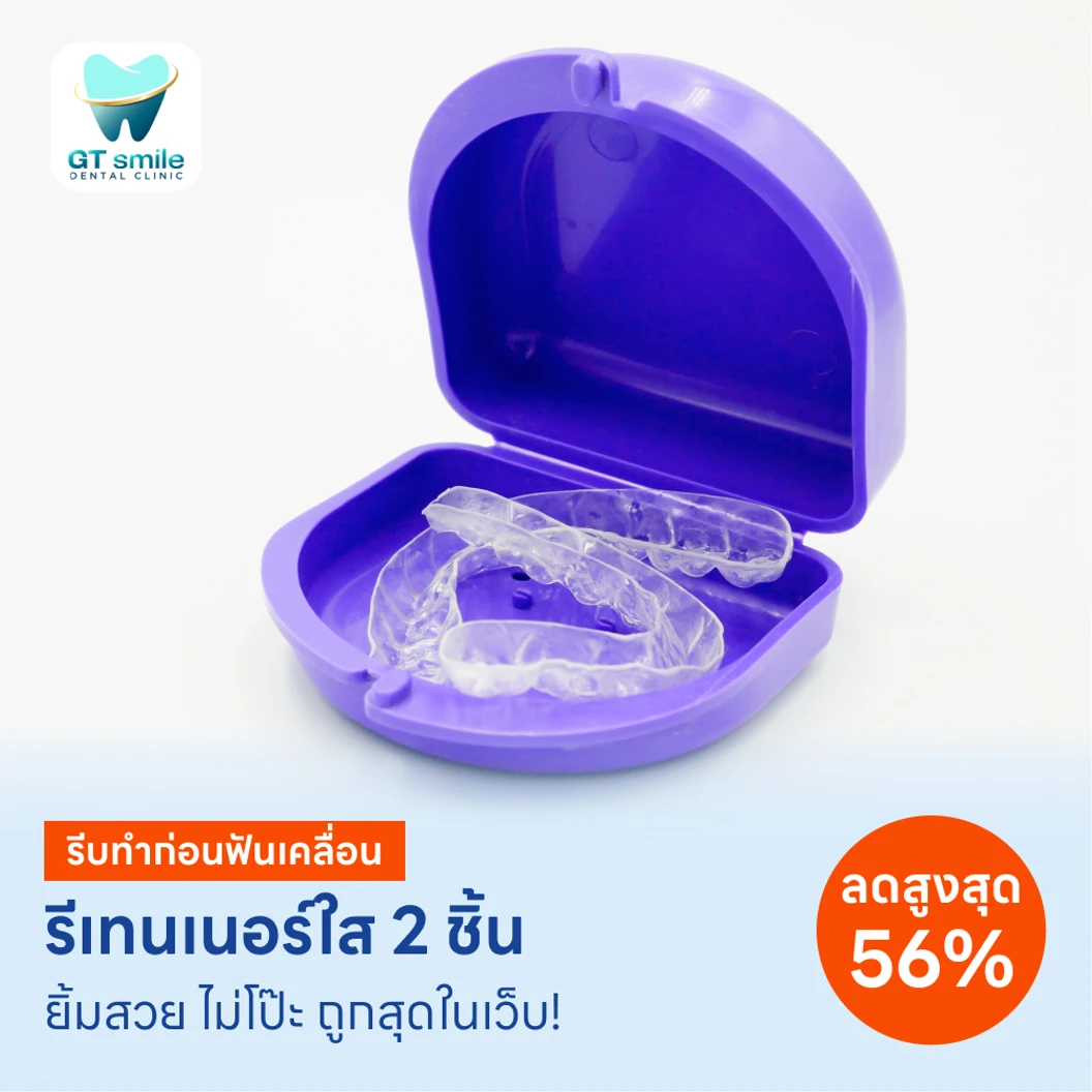 ทำรีเทนเนอร์แบบใส 2 ชิ้น