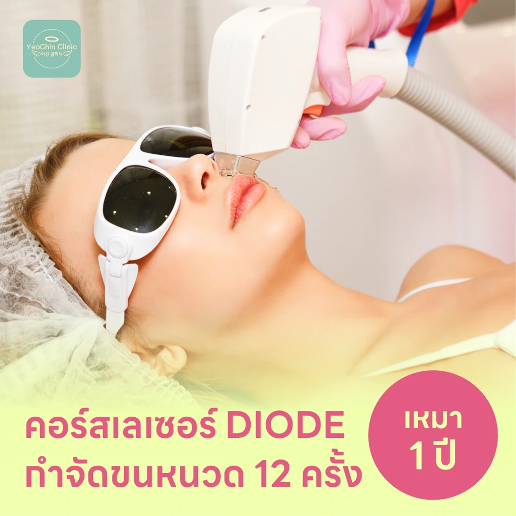 คอร์สเลเซอร์กำจัดขนหนวด 12 ครั้ง ด้วย Diode Laser