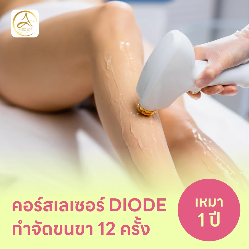 คอร์สเลเซอร์กำจัดขนทั่วขา 12 ครั้ง ด้วย Diode Laser
