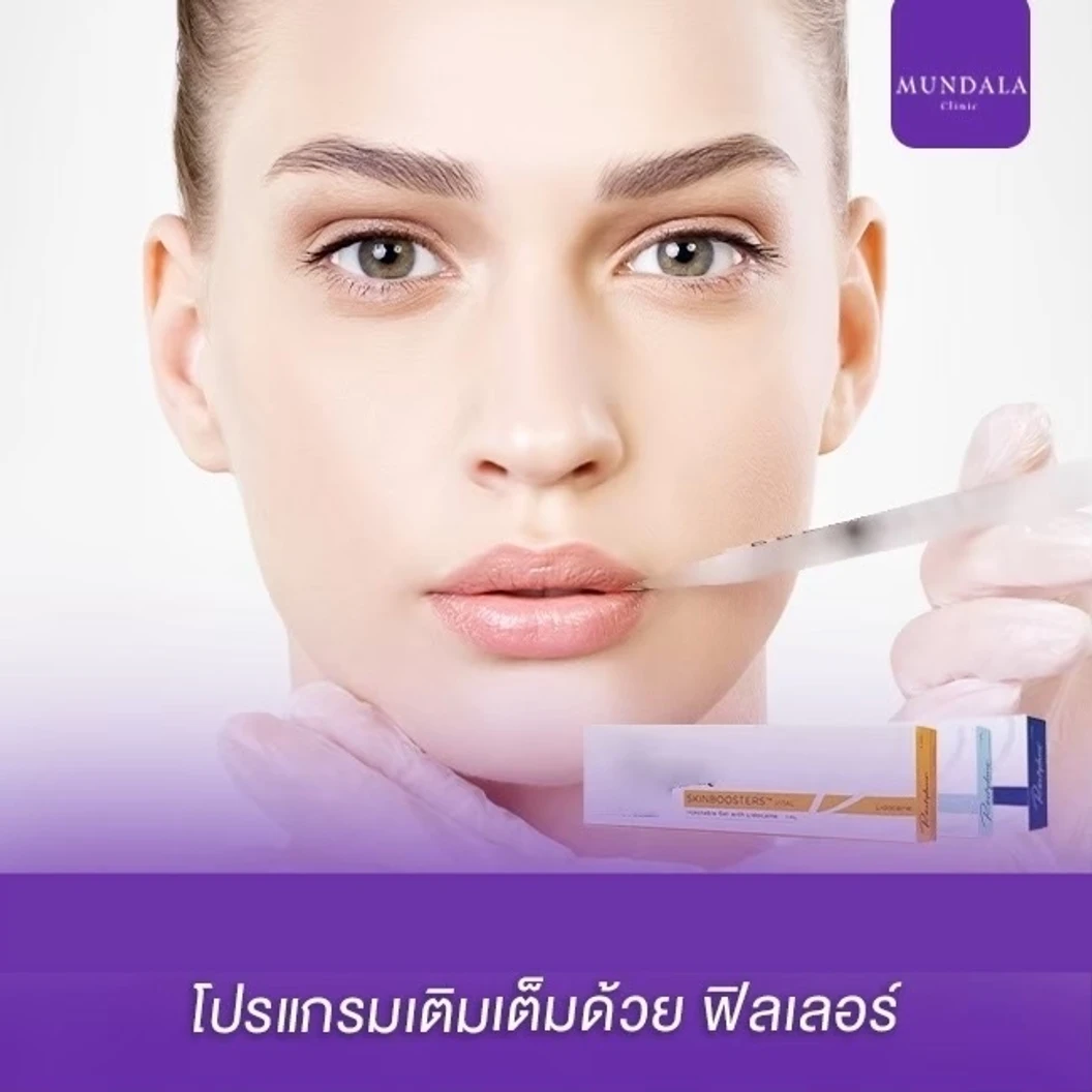 โปรแกรมฟิลเลอร์ 1 ซีซี (หน้า)