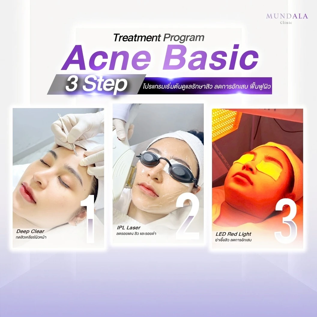 ทำทรีตเมนต์หน้า (โปรแกรม Acne Basic) 3 ขั้นตอน