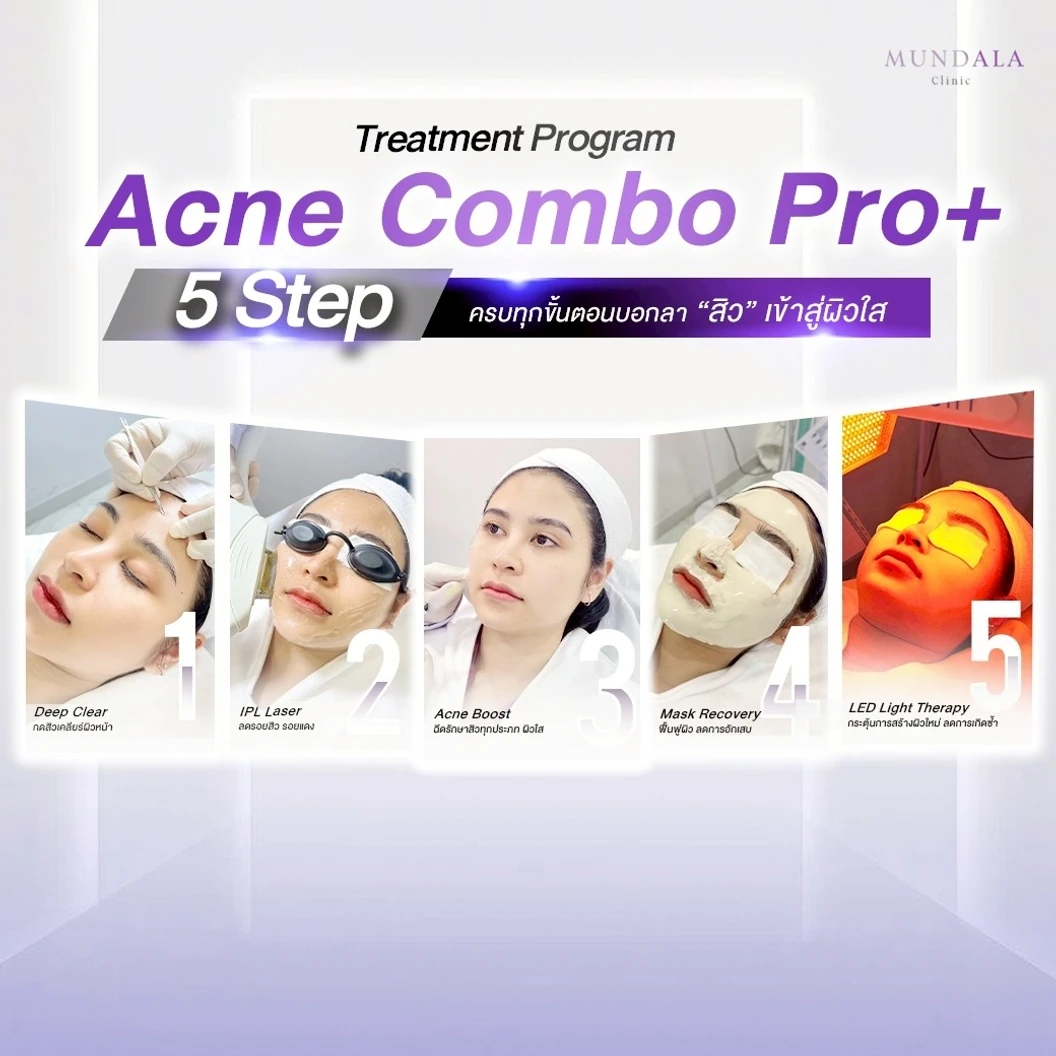คอร์สทำทรีตเมนต์หน้า (โปรแกรม Acne Combo Pro+) 5 ขั้นตอน 3 ครั้ง