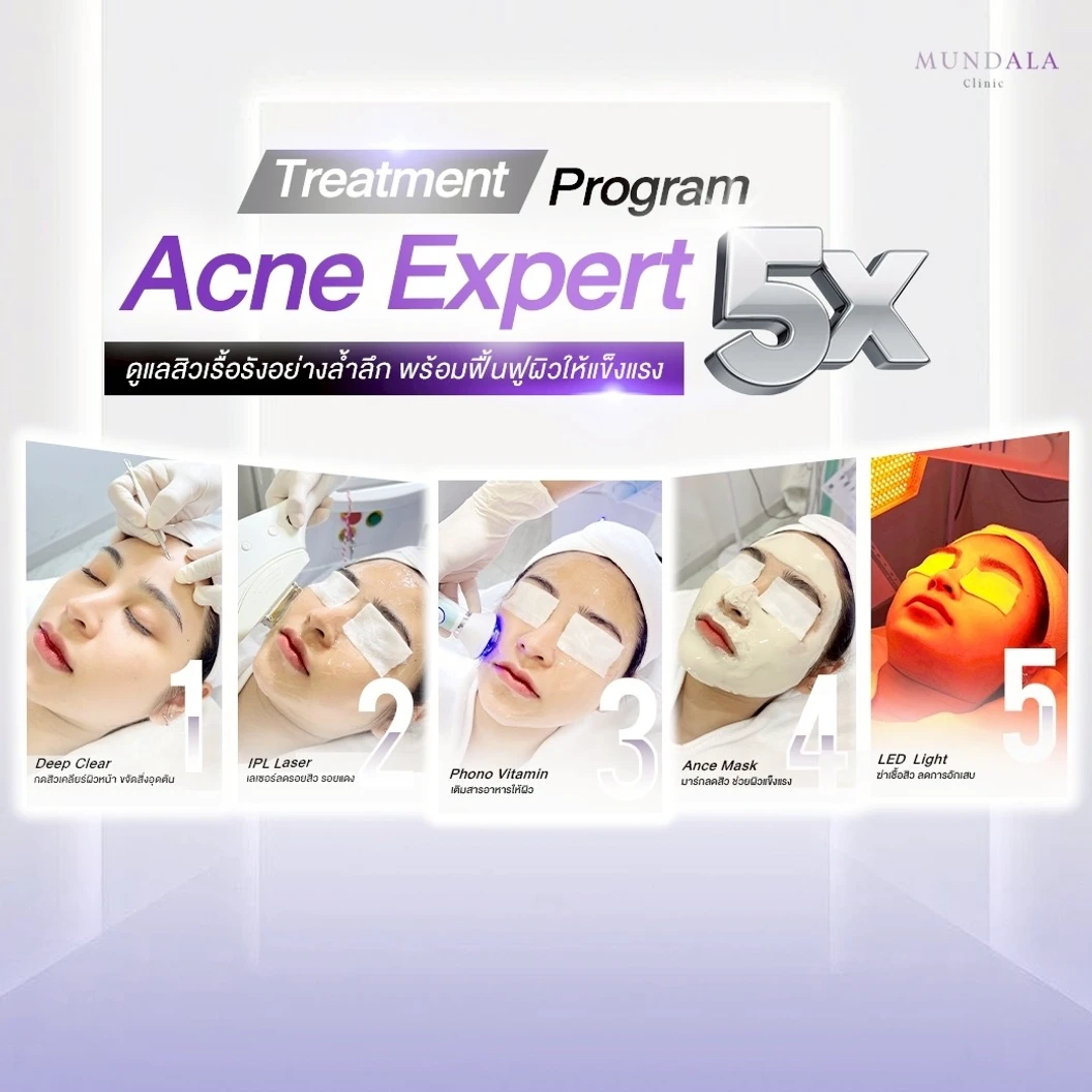 คอร์สทำทรีตเมนต์หน้า (โปรแกรม Acne Expert) 5 ขั้นตอน 5 ครั้ง ฟรี! 2 ครั้ง