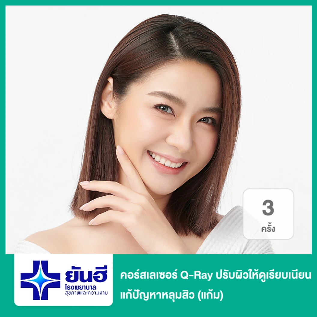 คอร์สเลเซอร์ Q-Ray ปรับผิวให้ดูเรียบเนียน แก้ปัญหาหลุมสิว 3 ครั้ง (แก้ม)