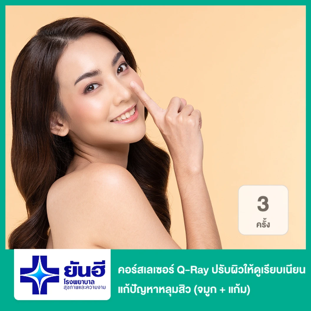 คอร์สเลเซอร์ Q-Ray ปรับผิวให้ดูเรียบเนียน แก้ปัญหาหลุมสิว 3 ครั้ง (จมูก + แก้ม)