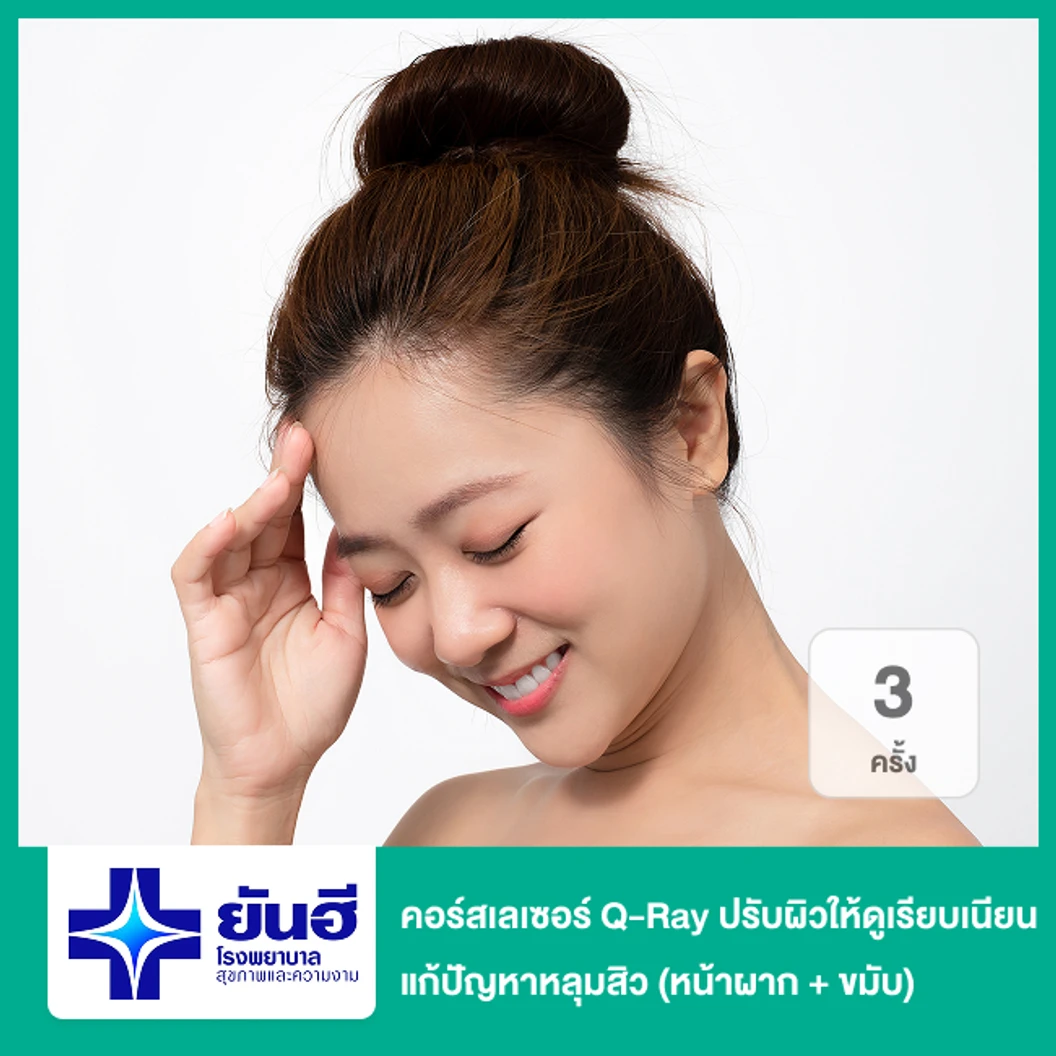 คอร์สเลเซอร์ Q-Ray ปรับผิวให้ดูเรียบเนียน แก้ปัญหาหลุมสิว 3 ครั้ง (หน้าผาก + ขมับ)