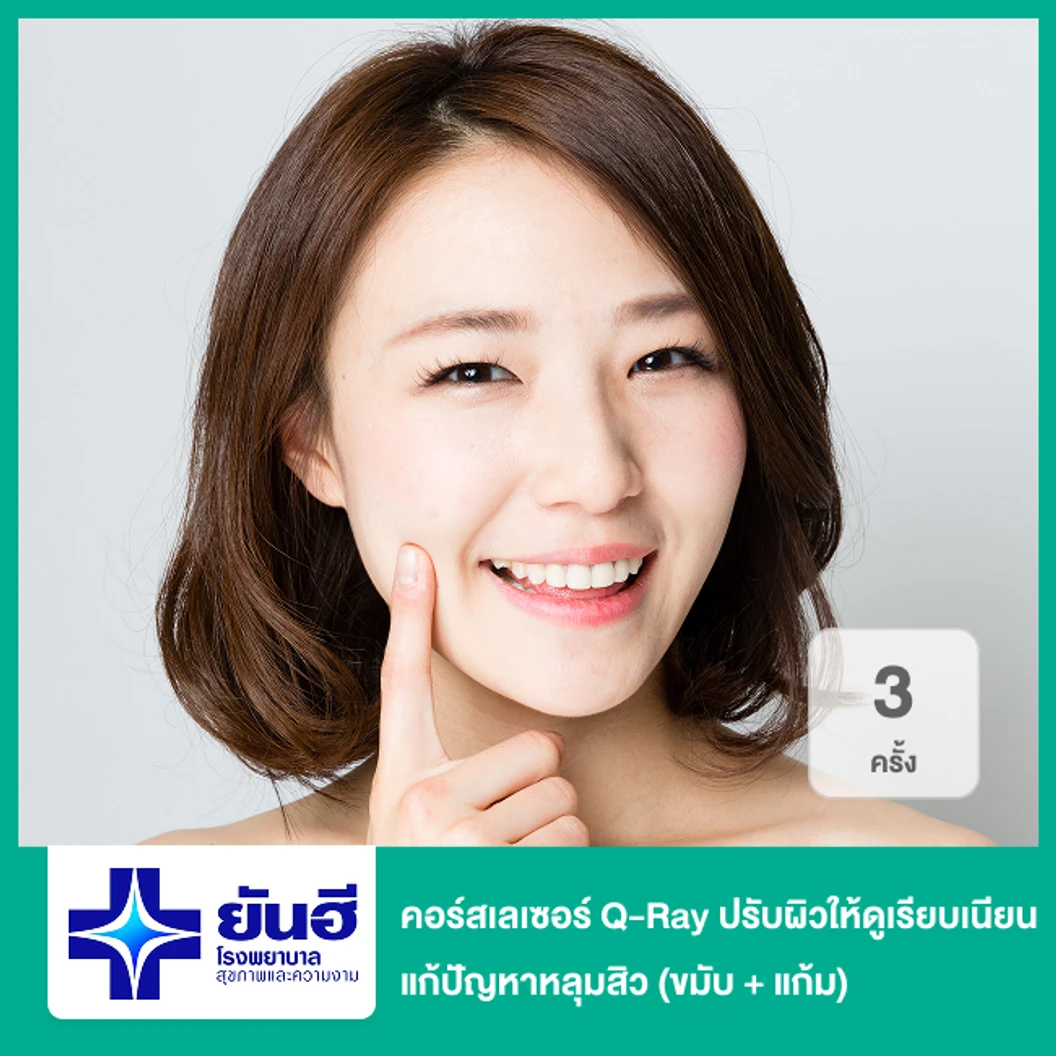 คอร์สเลเซอร์ Q-Ray ปรับผิวให้ดูเรียบเนียน แก้ปัญหาหลุมสิว 3 ครั้ง (ขมับ + แก้ม)