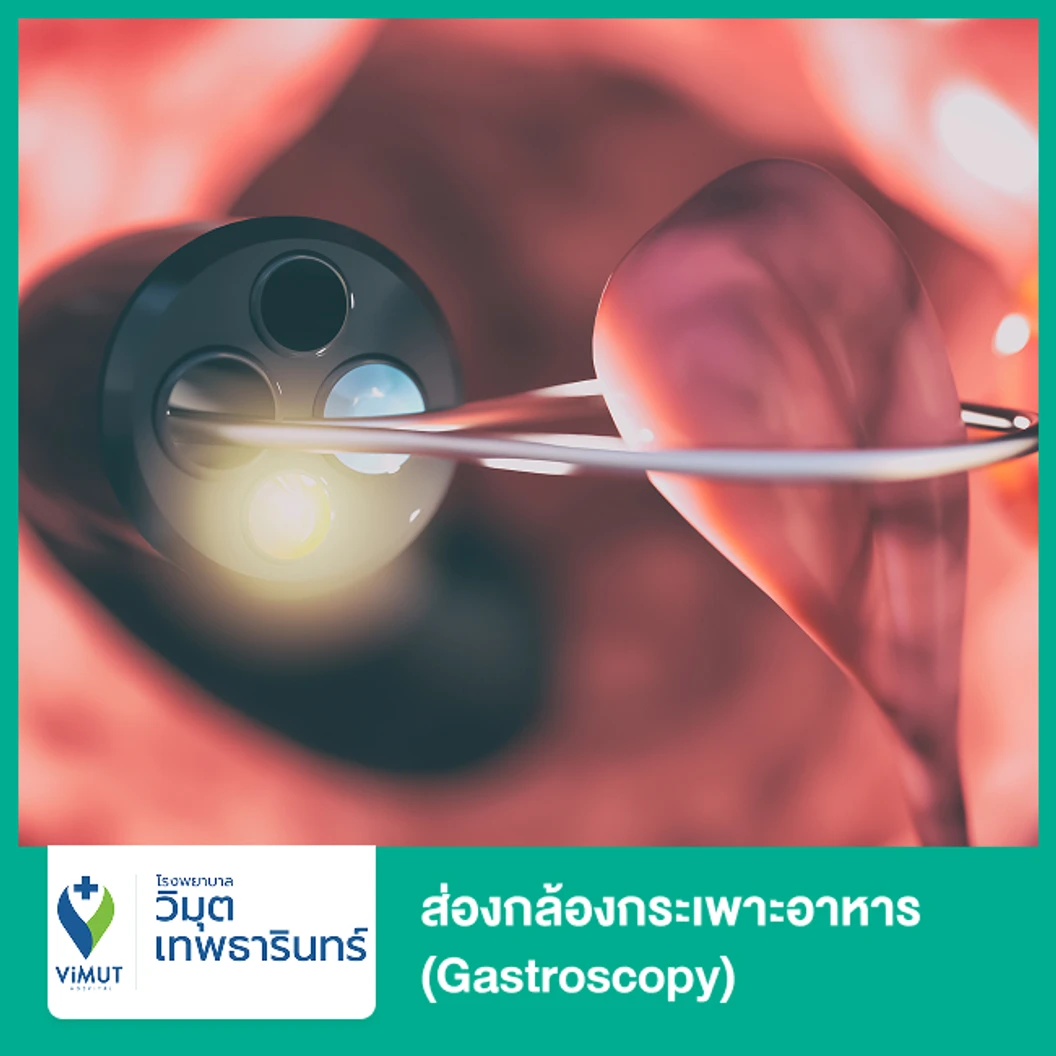 ส่องกล้องกระเพาะอาหาร (Gastroscopy) ด้วยวิธีให้ยานอนหลับ โดยวิสัญญีแพทย์