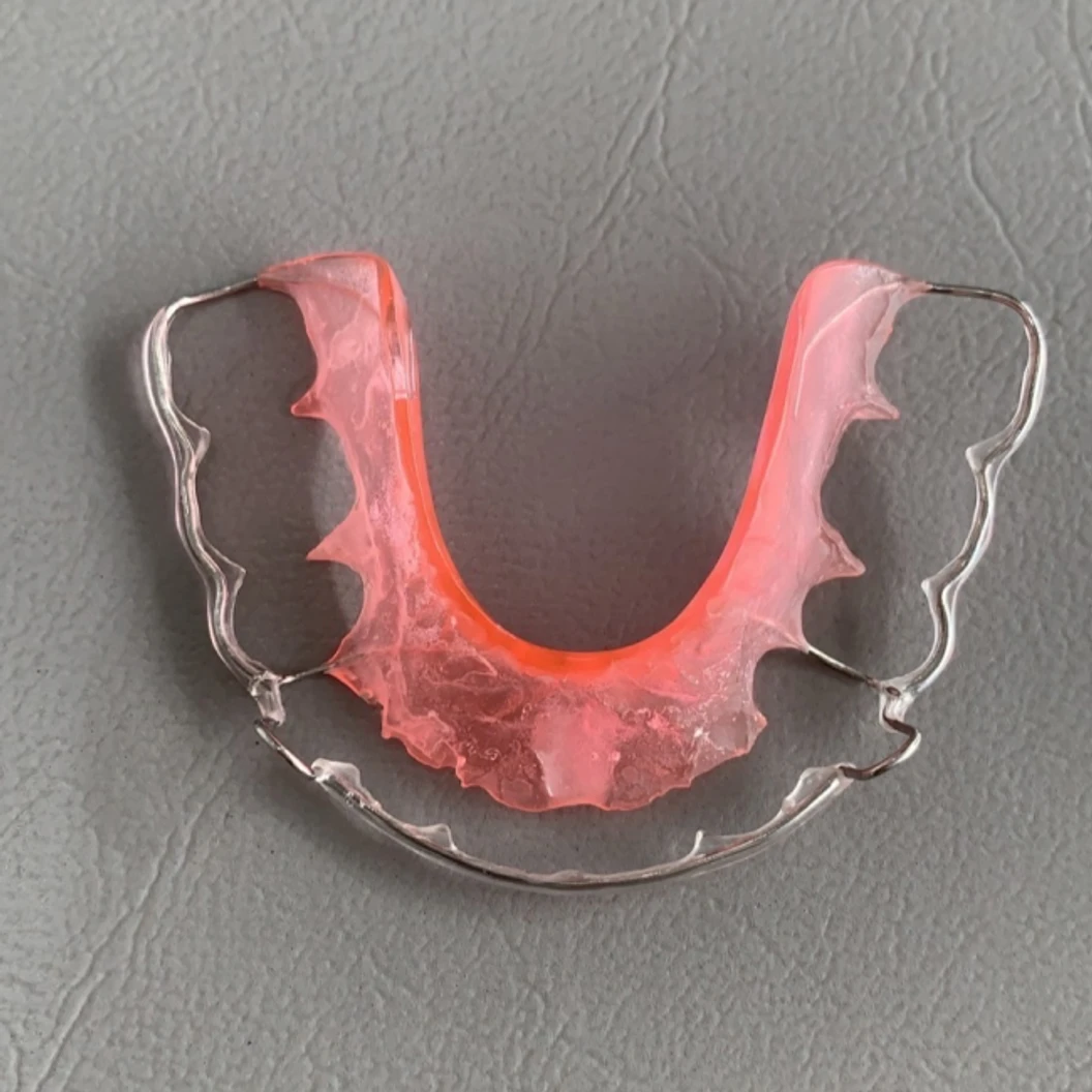 ทำรีเทนเนอร์แบบลวด 1 ชิ้น