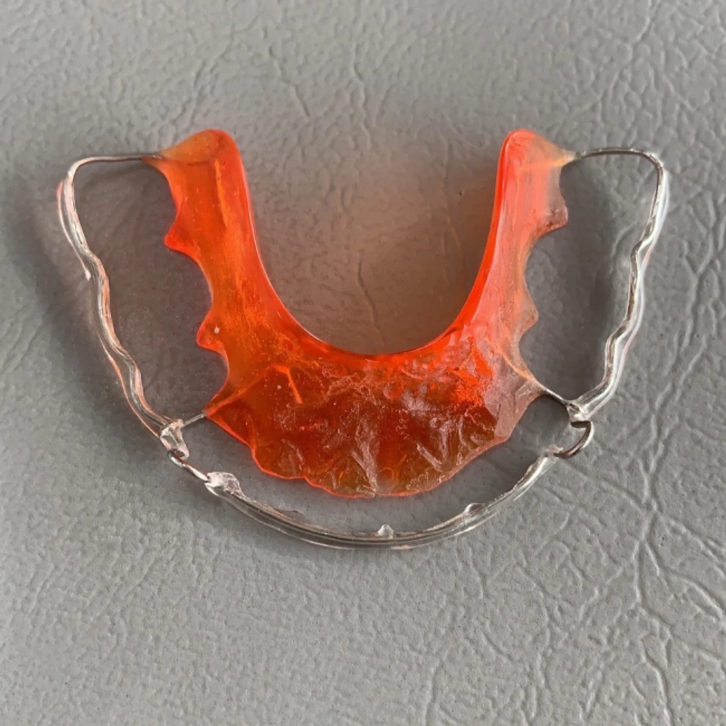 ทำรีเทนเนอร์แบบลวด 1 ชิ้น