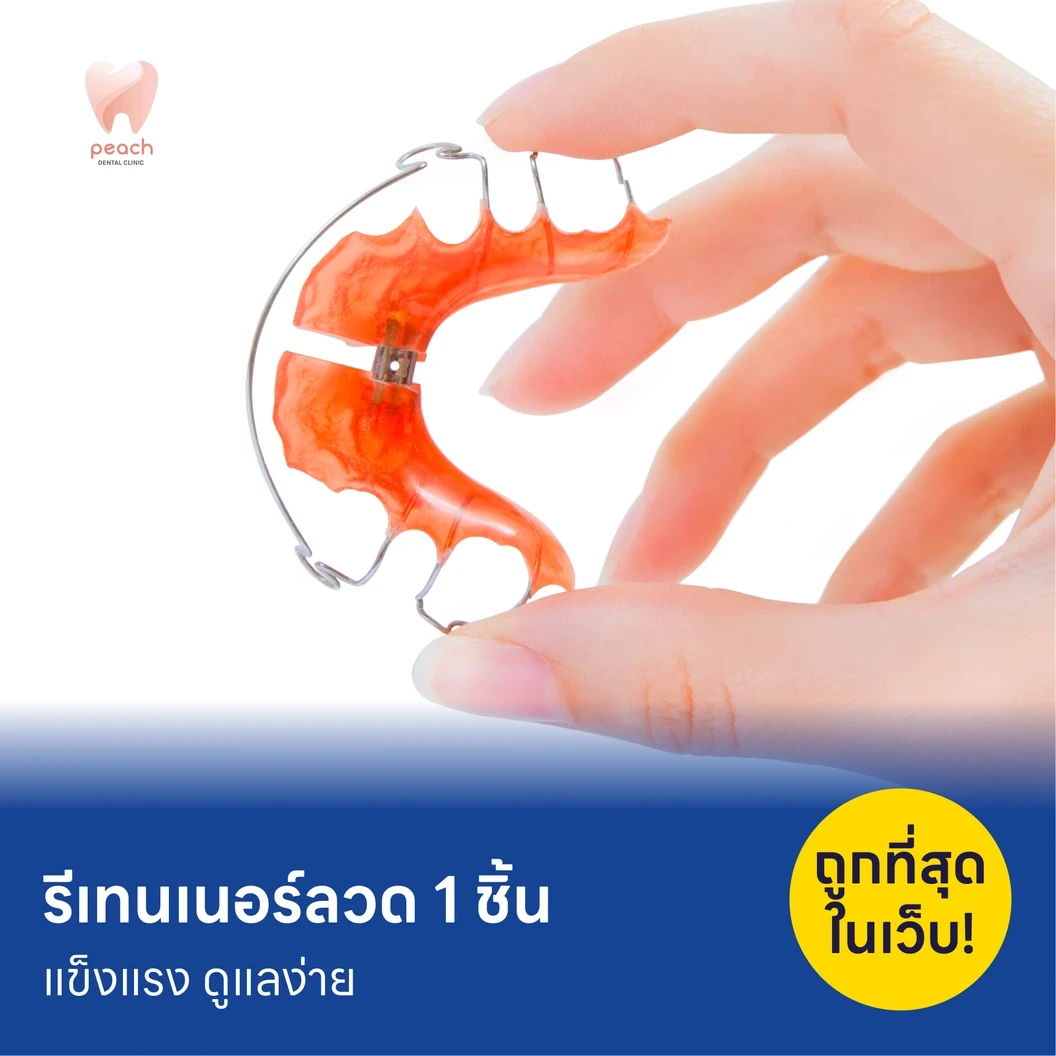 ทำรีเทนเนอร์แบบลวด 1 ชิ้น