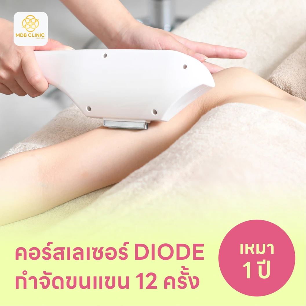 คอร์สเลเซอร์กำจัดขนทั่วแขน 12 ครั้ง ด้วย Diode Laser