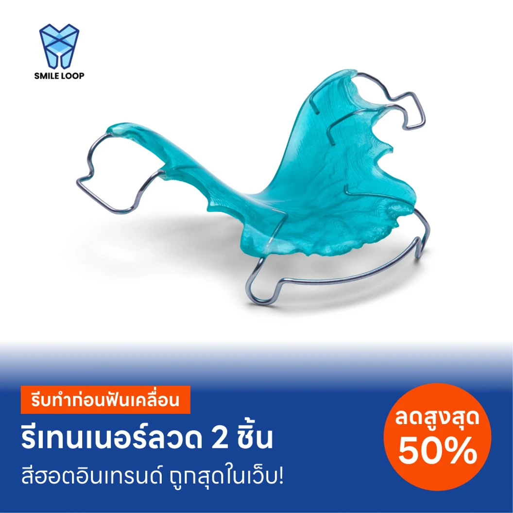 ทำรีเทนเนอร์แบบลวด 2 ชิ้น ฟันบนและล่าง