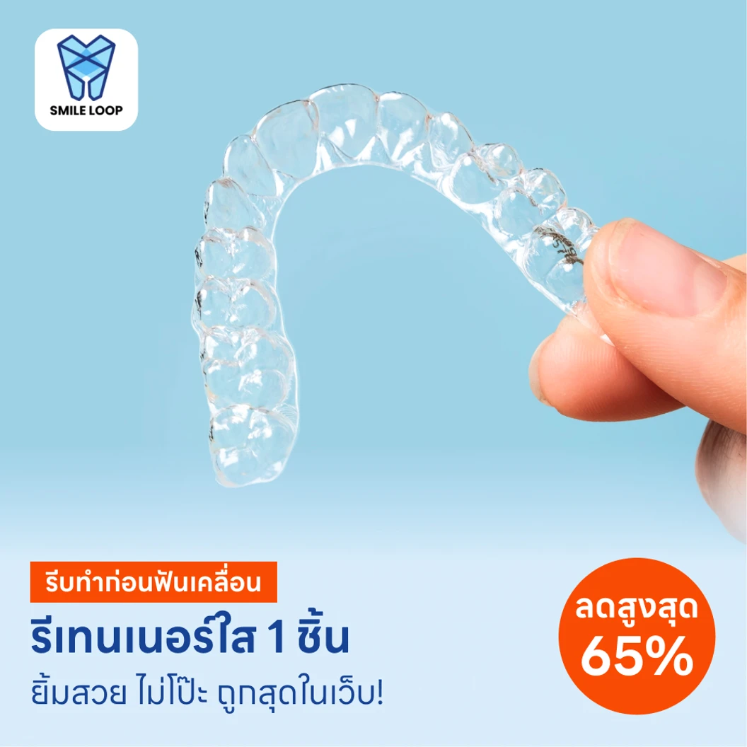 ทำรีเทนเนอร์แบบใส 1 ชิ้น