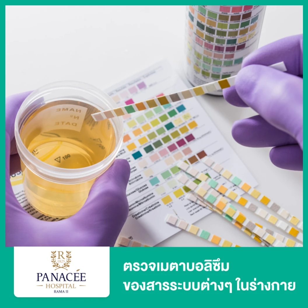 ตรวจเมตาบอลิซึมของสารระบบต่างๆ ในร่างกาย ด้วย Urine Organic