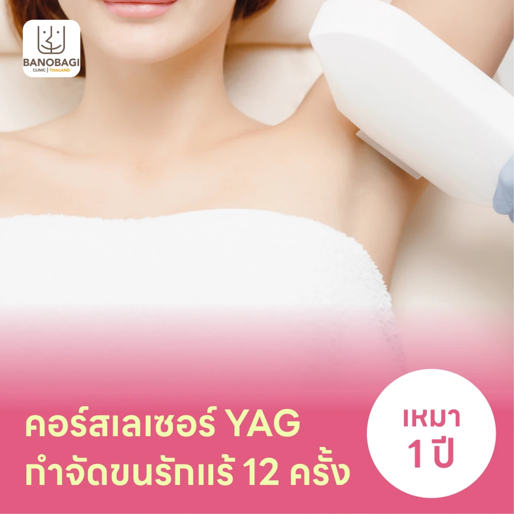 คอร์สเลเซอร์กำจัดขนรักแร้ 12 ครั้ง ด้วย YAG Laser