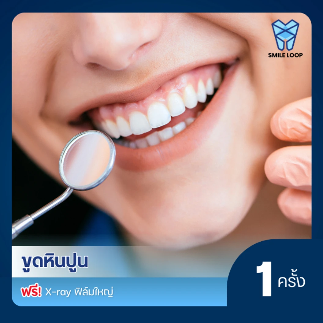 ขูดหินปูน ฟรี! X-ray ฟิล์มใหญ่