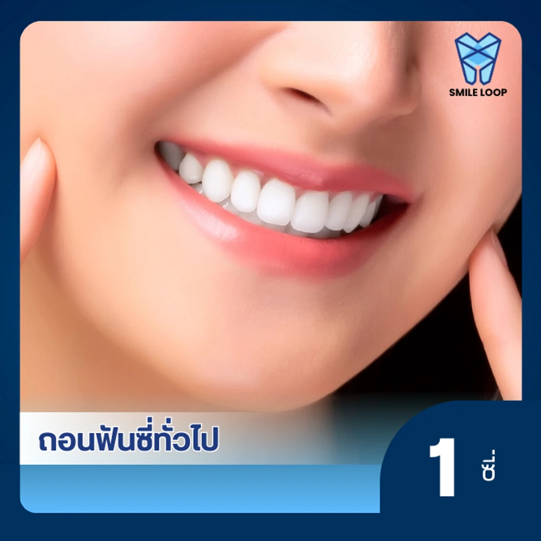 ถอนฟันทั่วไป 1 ซี่