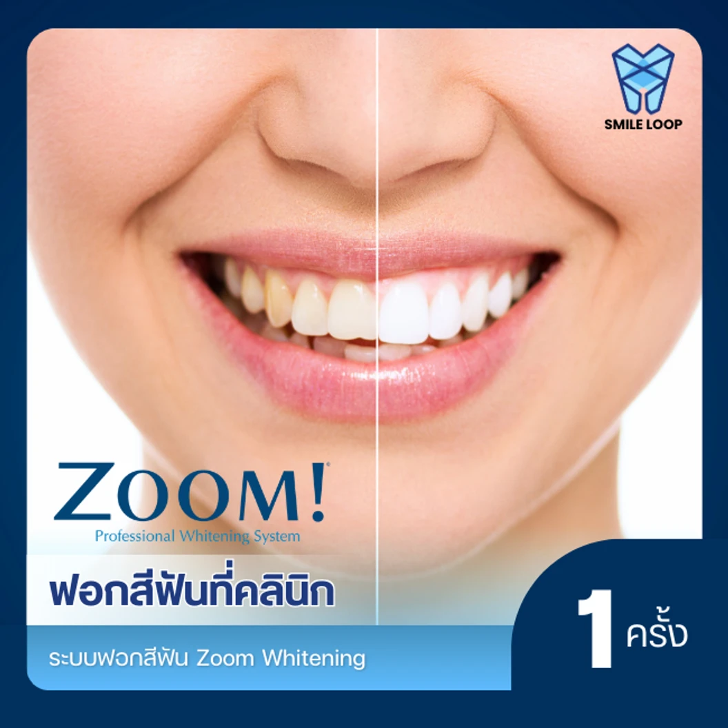 ฟอกสีฟันที่คลินิก ด้วยระบบ Zoom
