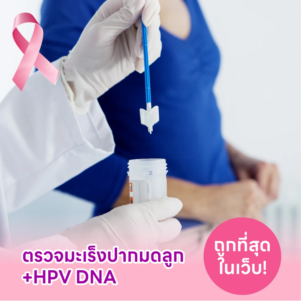 ตรวจมะเร็งปากมดลูก และตรวจหาเชื้อ HPV ด้วย DNA