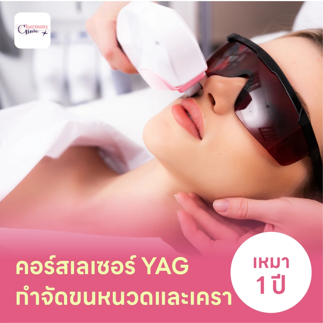 คอร์สเลเซอร์กำจัดขนหนวดและเครา 12 ครั้ง ด้วย YAG Laser