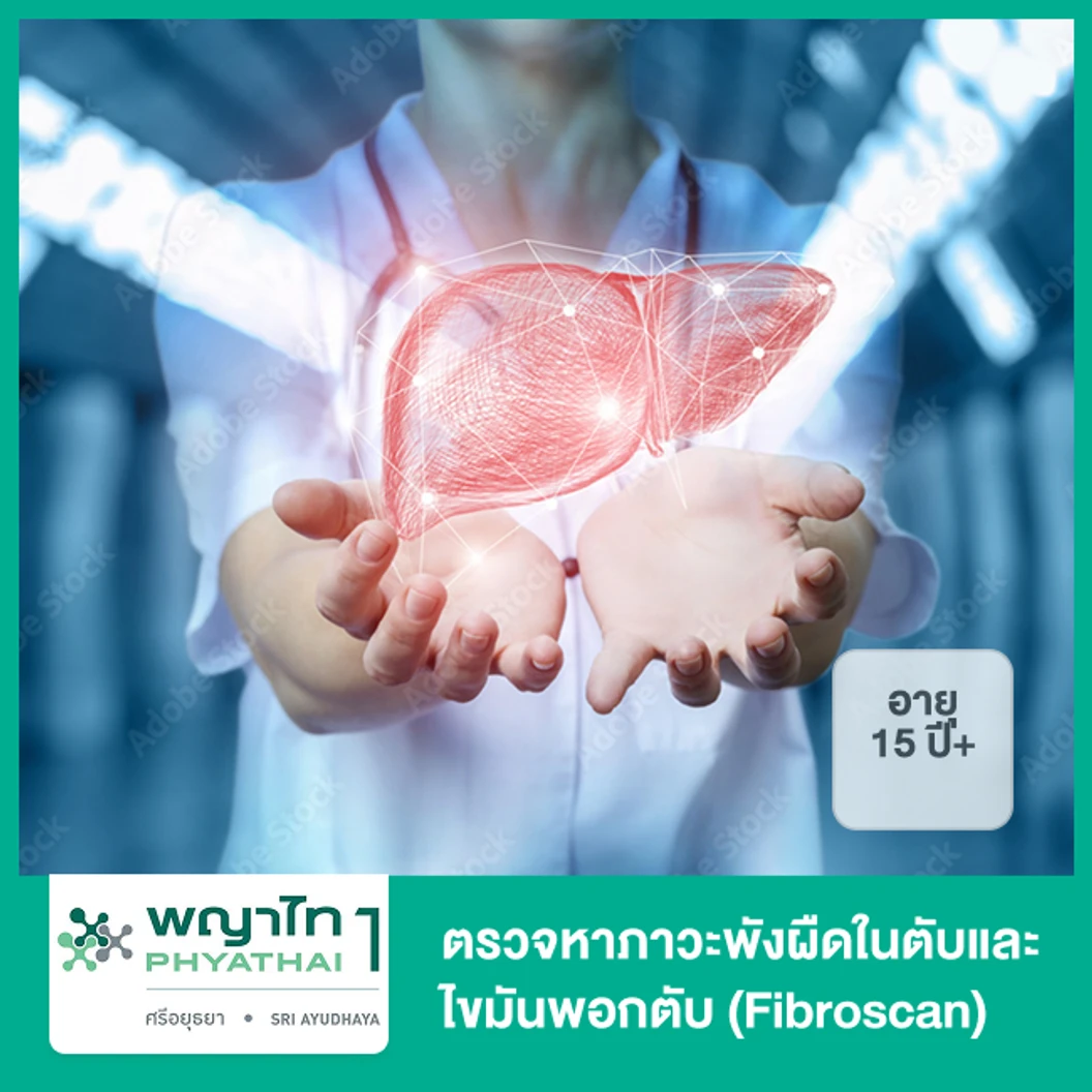 ตรวจหาภาวะพังผืดในตับและไขมันพอกตับ (Fibroscan) (15 ปีขึ้นไป)