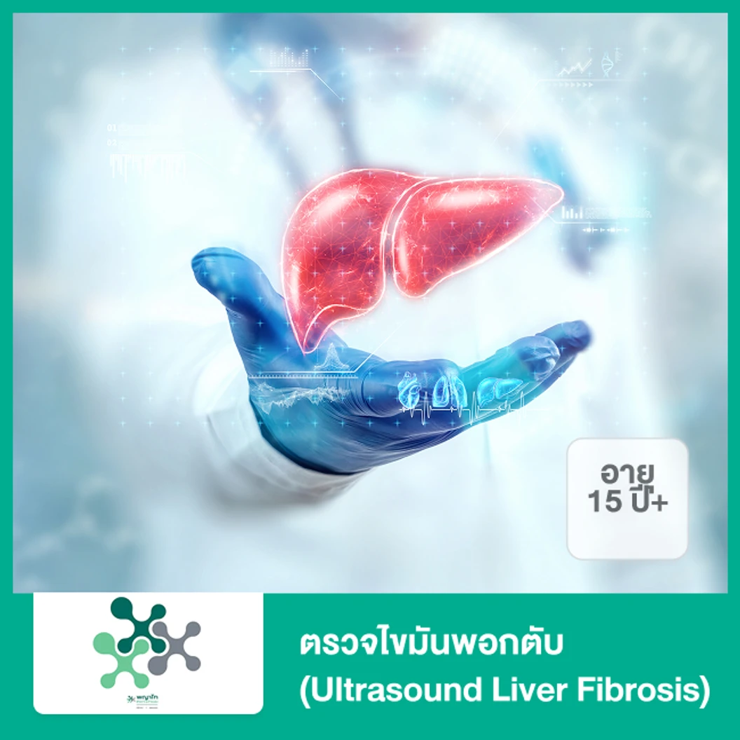 ตรวจไขมันพอกตับ (Ultrasound Liver Fibrosis) (15 ปีขึ้นไป)
