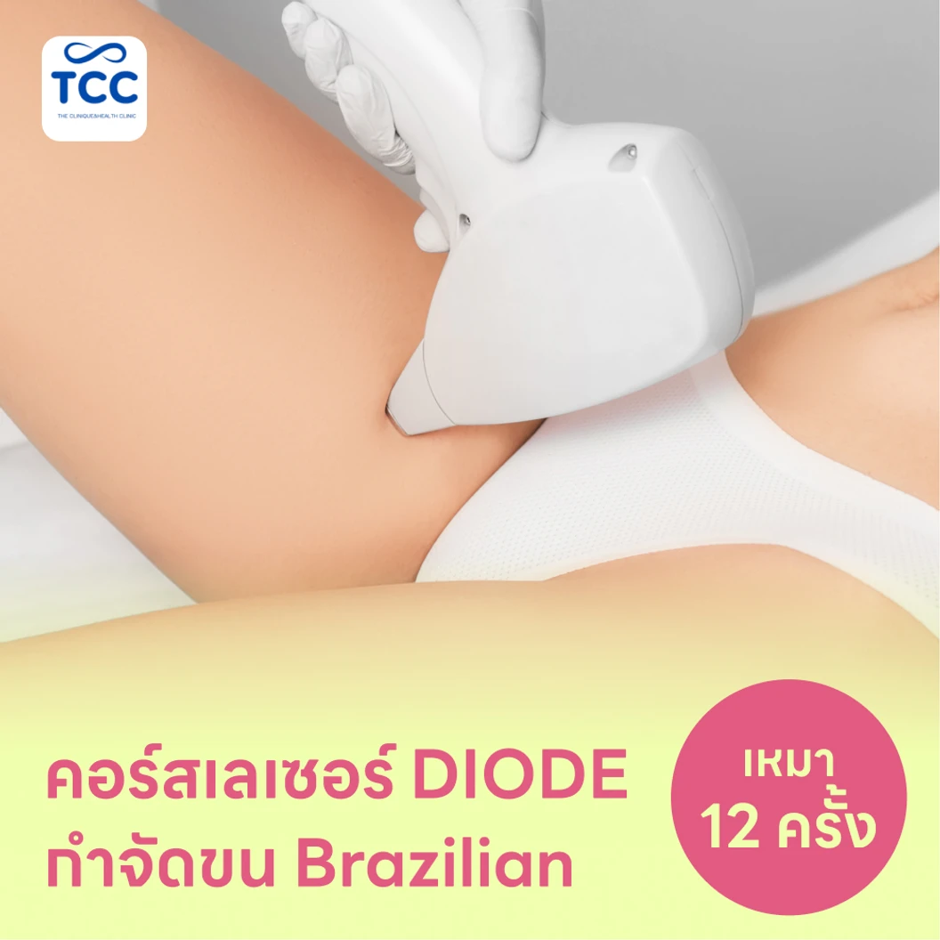 คอร์สเลเซอร์กำจัดขนน้องสาวแบบ Brazilian (vVI) 12 ครั้ง ด้วย Diode Laser