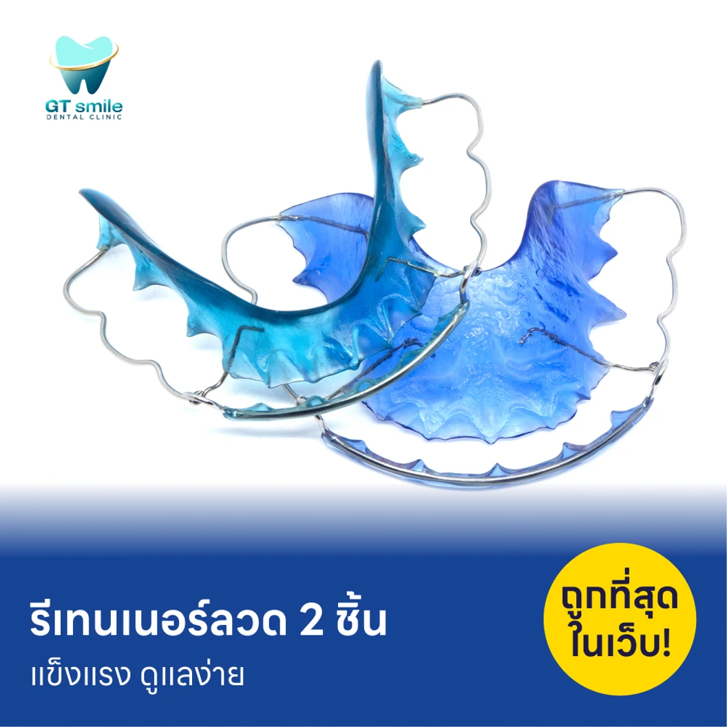 ทำรีเทนเนอร์แบบลวด 2 ชิ้น ฟันบนและล่าง