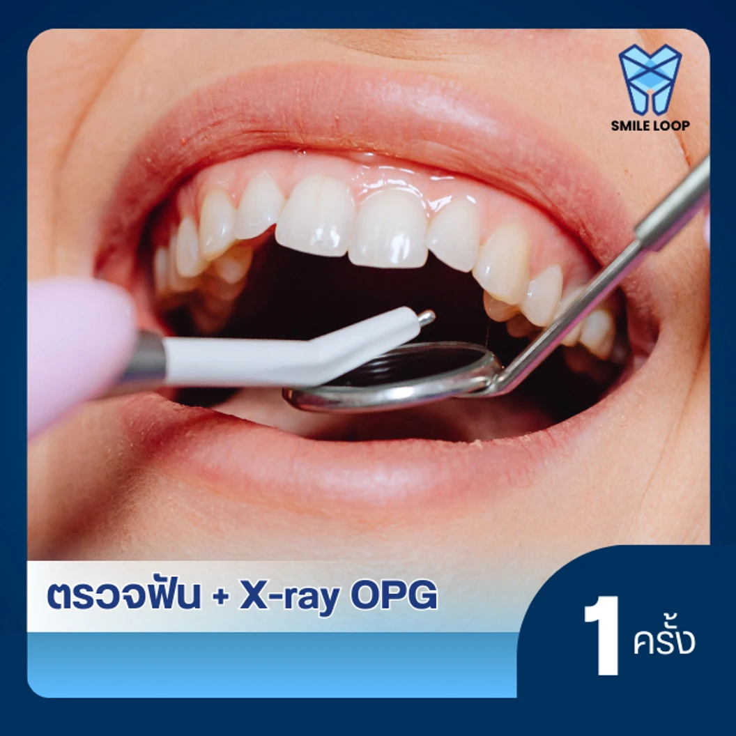 ตรวจสุขภาพฟัน ฟรี! เอกซเรย์ (X-ray) ฟิล์มใหญ่ 1 ฟิล์ม