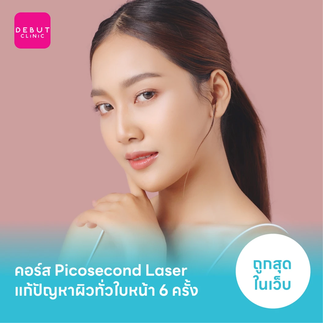 คอร์ส Picosecond Laser แก้ปัญหาผิวทั่วใบหน้า 6 ครั้ง