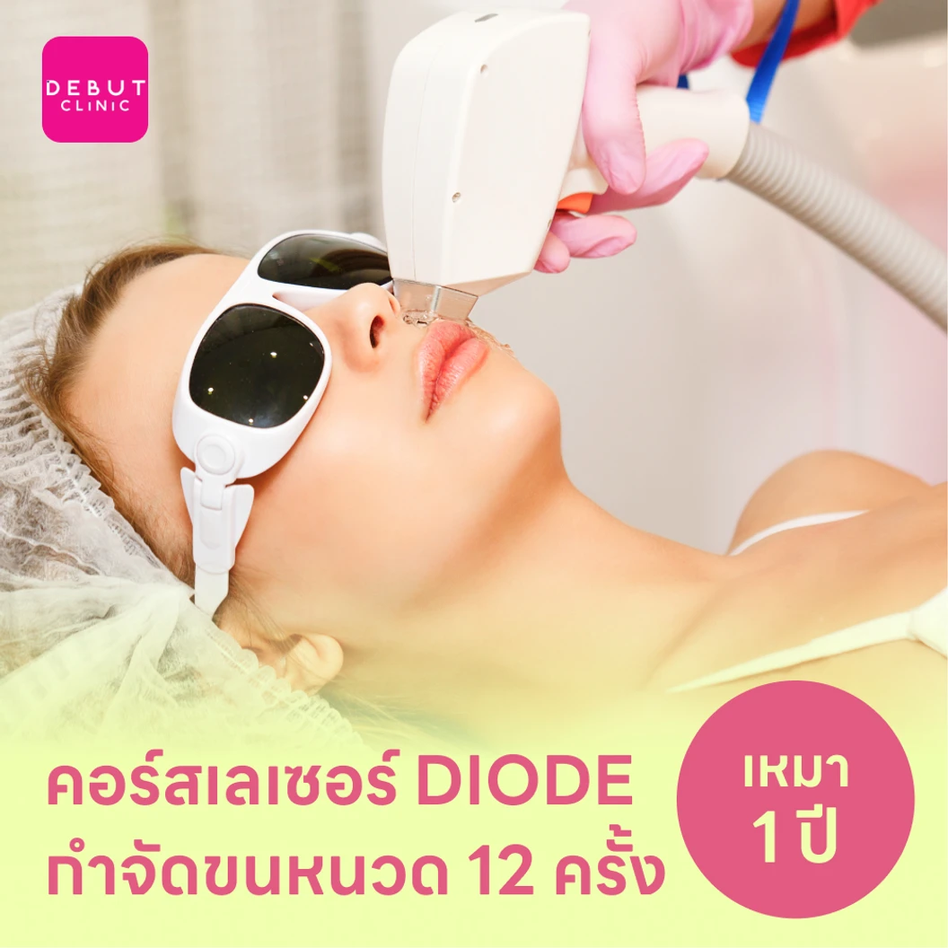 คอร์สเลเซอร์กำจัดขนหนวด 12 ครั้ง ด้วย Diode Laser
