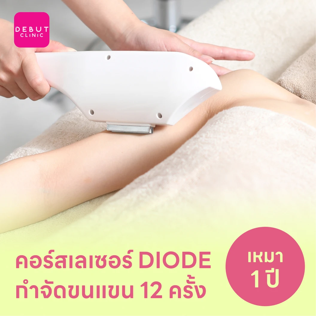 คอร์สเลเซอร์กำจัดขนทั่วแขน 12 ครั้ง ด้วย Diode Laser