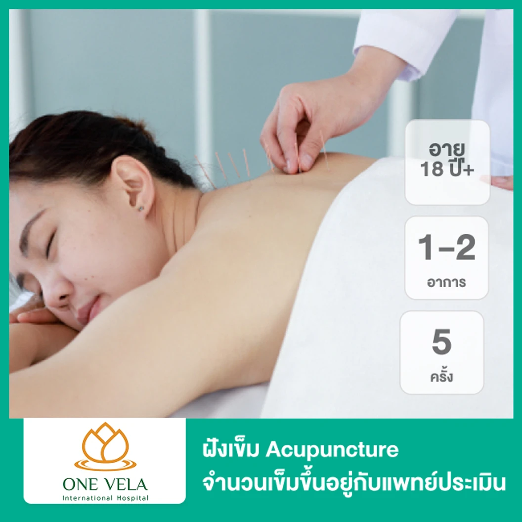 ฝังเข็ม Acupuncture (1-2 อาการ) 5 ครั้ง จำนวนเข็มขึ้นอยู่กับแพทย์ประเมิน (18 ปีขึ้นไป)