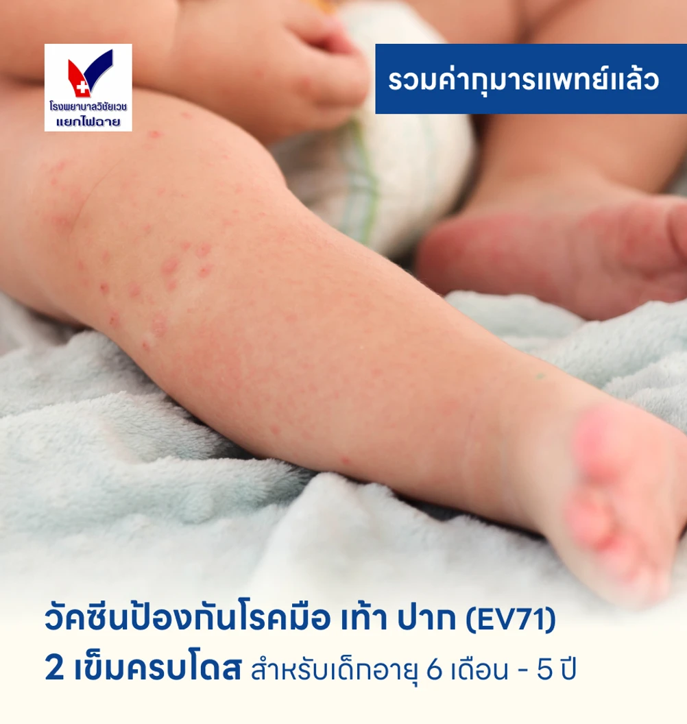 วัคซีนป้องกันโรคมือ เท้า ปาก 2 เข็ม (ครบโดส) สำหรับเด็กอายุ 6 เดือน-5 ปี