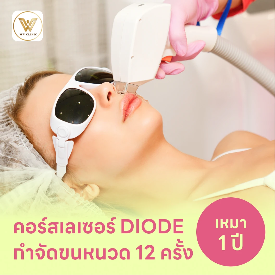 คอร์สเลเซอร์กำจัดขนหนวด 12 ครั้ง ด้วย Diode Laser