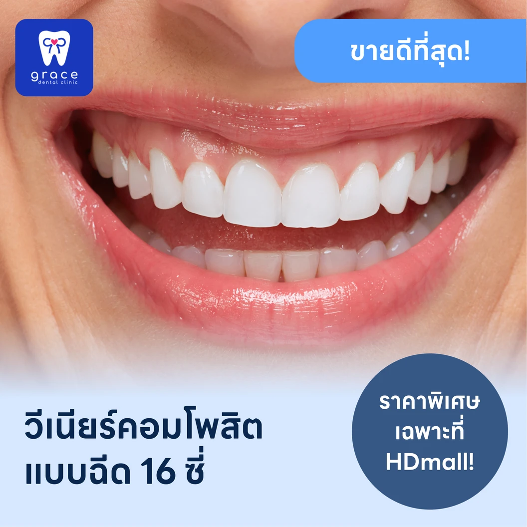 ทำวีเนียร์คอมโพสิตแบบฉีด 16 ซี่