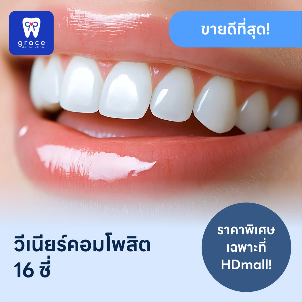 ทำวีเนียร์คอมโพสิต 16 ซี่