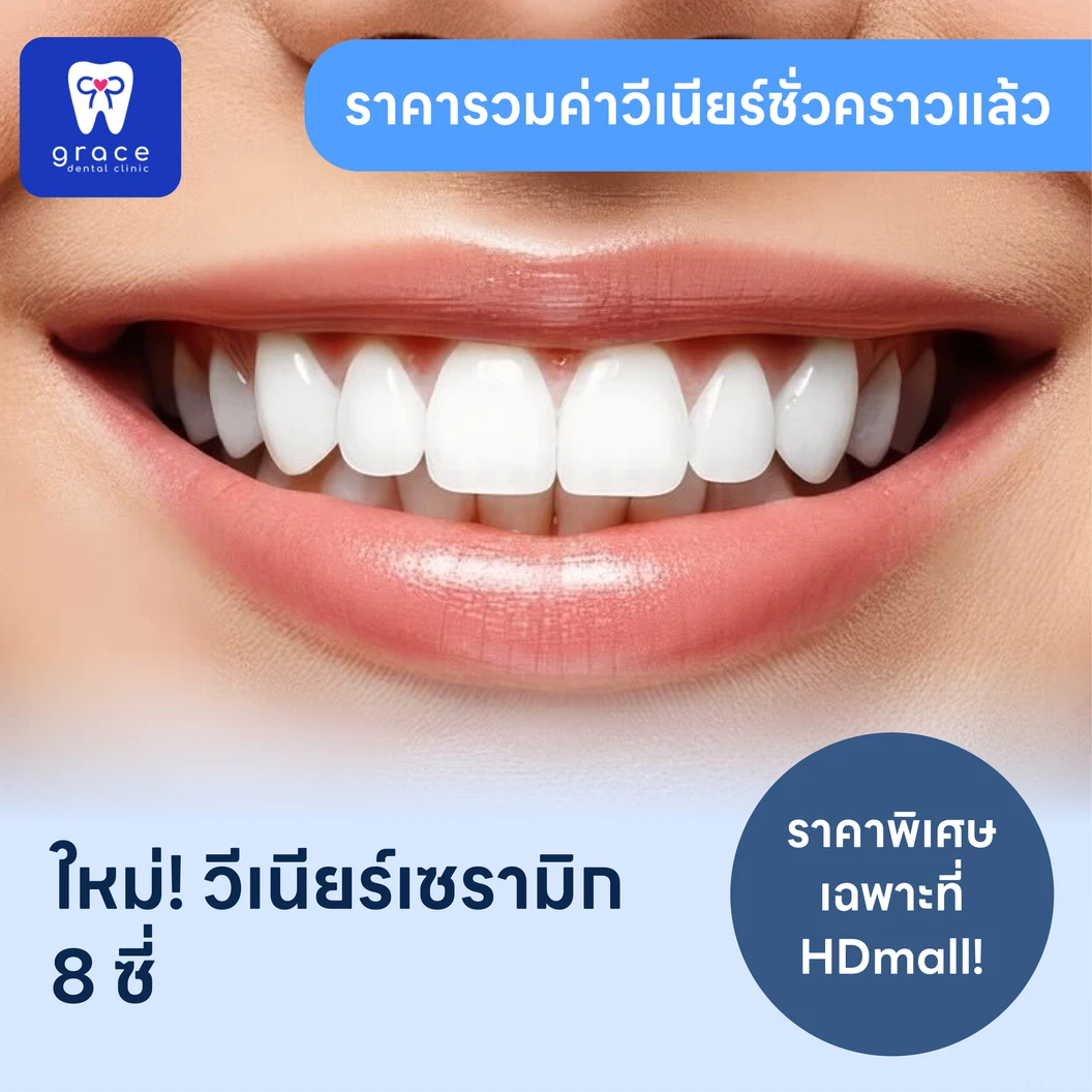 ทำวีเนียร์เซรามิก E-Max Press 8 ซี่
