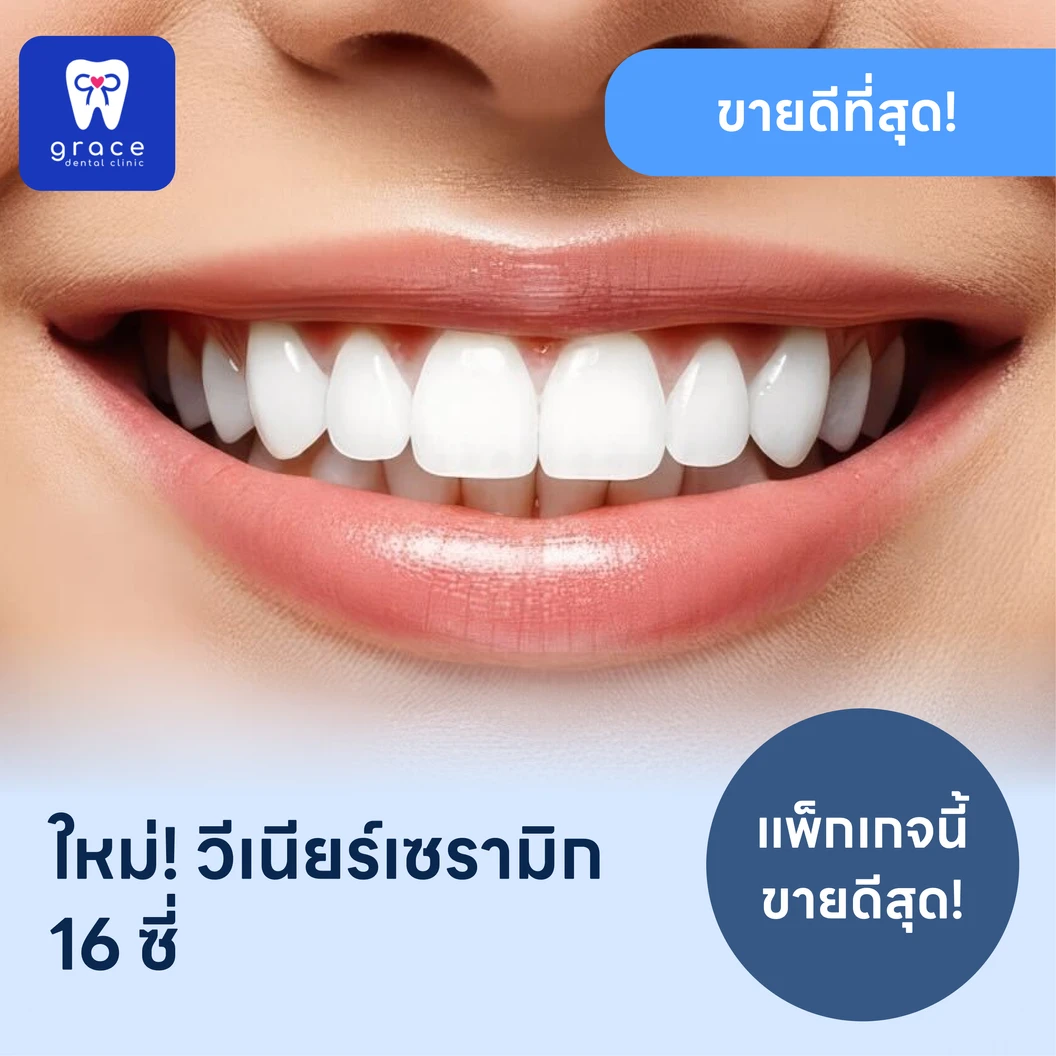 ทำวีเนียร์เซรามิก E-Max Press 16 ซี่