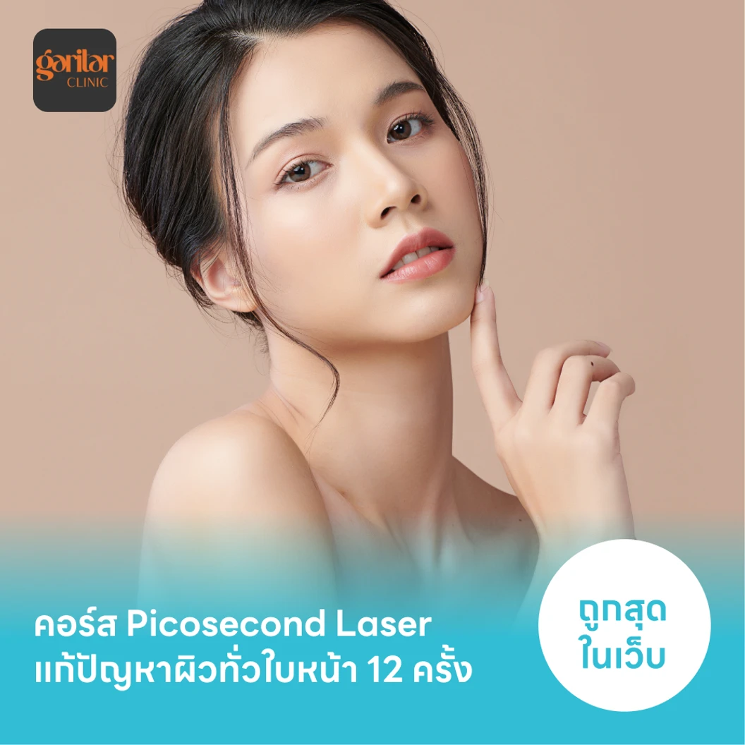 คอร์ส Picosecond Laser แก้ปัญหาผิวทั่วใบหน้า 12 ครั้ง