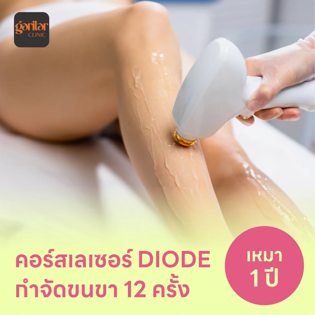 คอร์สเลเซอร์กำจัดขนทั่วขา 12 ครั้ง ด้วย Diode Laser