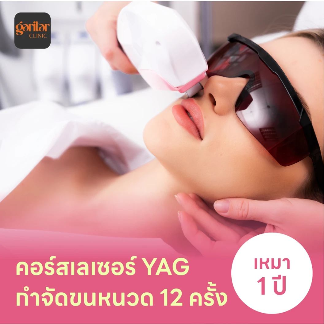 คอร์สเลเซอร์กำจัดขนหนวด 12 ครั้ง ด้วย YAG Laser