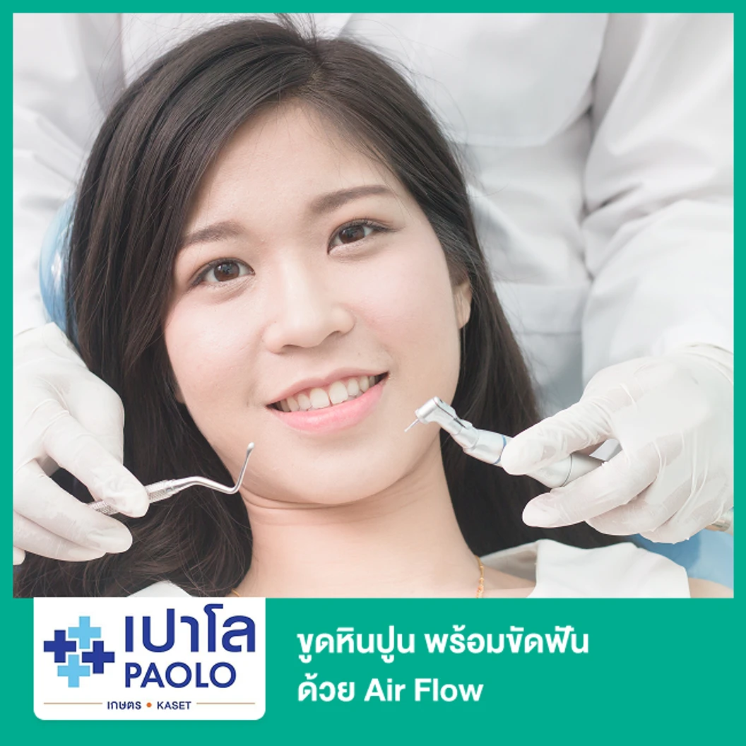 ขูดหินปูน พร้อมขัดฟันด้วย Air Flow แบบ EMS