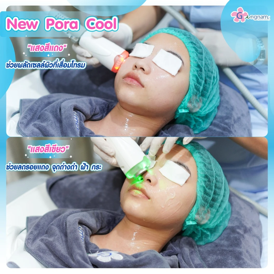 ทำทรีตเมนต์ New Pora Cool เติมวิตามินผิว ให้ผิวแข็งแรง กระจ่างใส ชุ่มชื้น รูขุมขนดูเล็กลง 1 ครั้ง